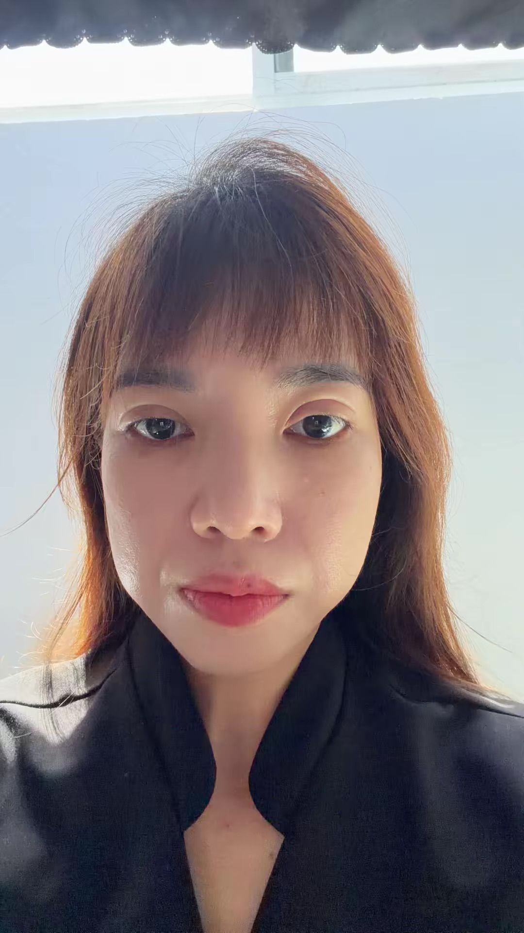 Ảnh mô tả số 2 Sunny